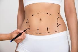 Are Mixed Emotions normal after a Tummy Tuck procedure? - The New You Recovery Kit